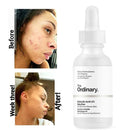 The Ordinary Salicylic Acid 2% Solution – 30ml